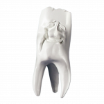 Hinrichs Zahnkollektion „Manni“ Gipszähne